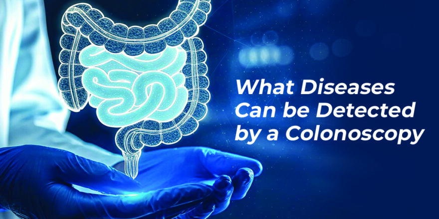 What Diseases Can be Detected by a Colonoscopy