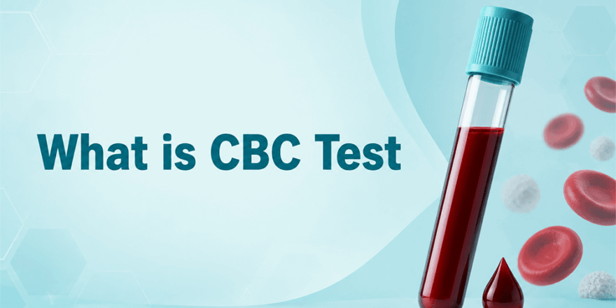 cbc test